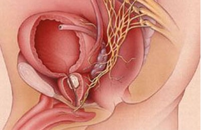苗药健康养生前列腺是男性最大的附属腺体,在男性生理