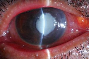 眼部带状疱疹是一种性质较为严重的睑皮肤病