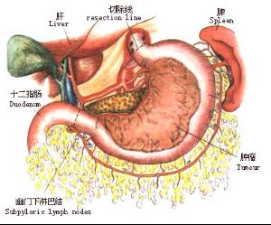 金方苗药集团肠胃知识简介你了解你的肠胃吗?